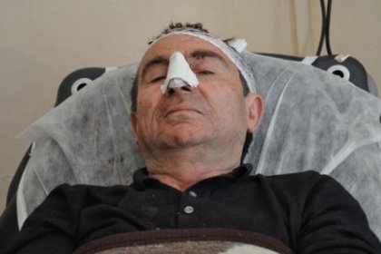 BDP milletvekili Halil Aksoy trafik kazası geçirdi