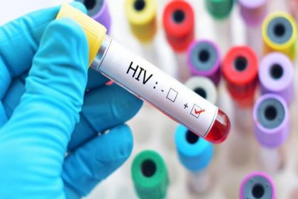 19 yıl sonra yeni HIV türü bulundu