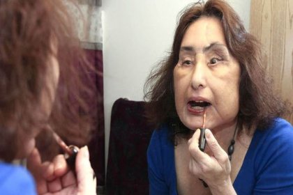 ABD’de ilk yüz nakli yapılan Connie Culp hayatını kaybetti